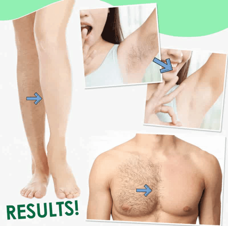 Promotion Sale! Hair Removal Spray 8 mins Hair Off